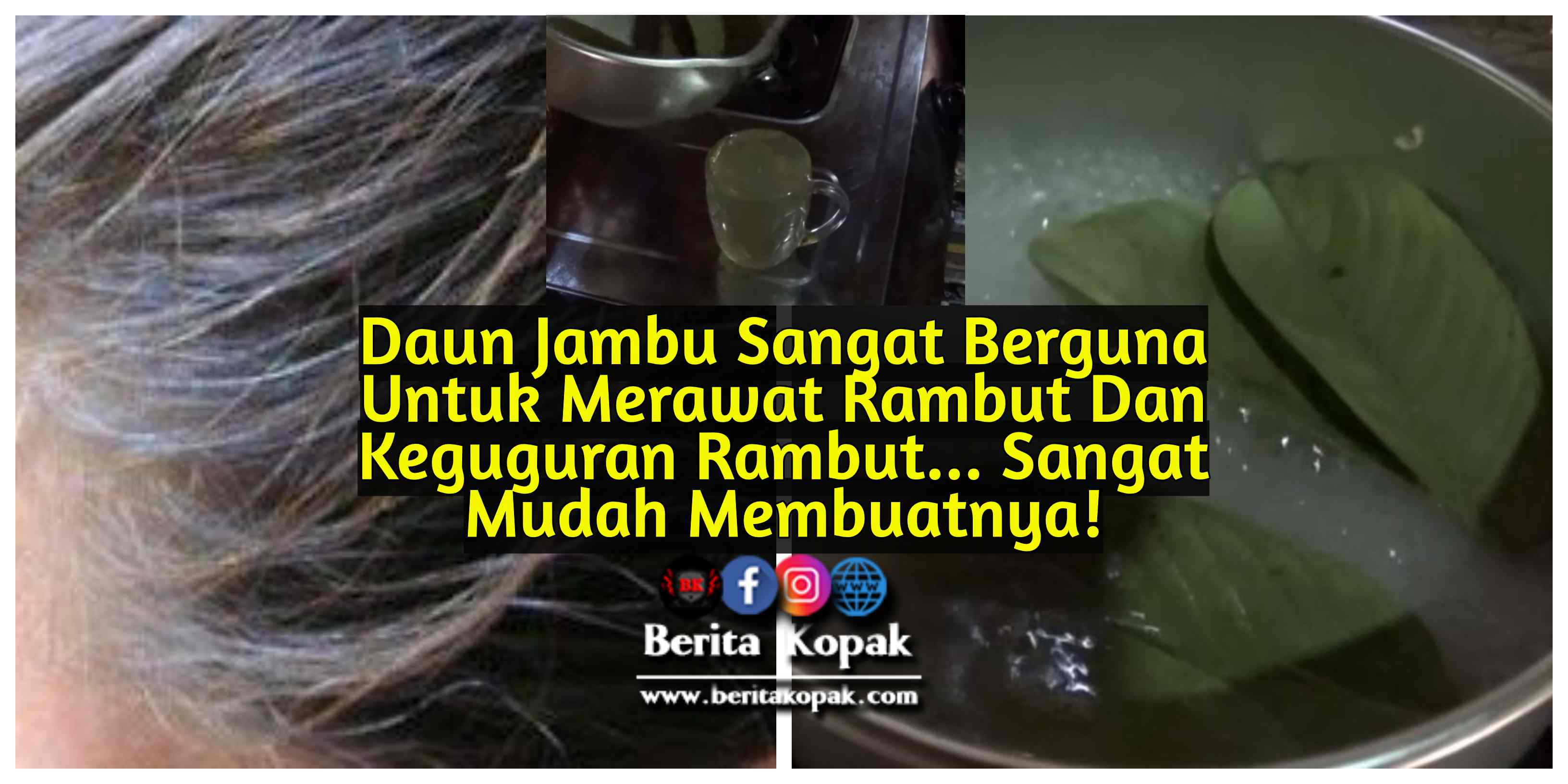 Ada Masalah Rambut Gugur ? Kepala Hampir Botak ? Jangan 